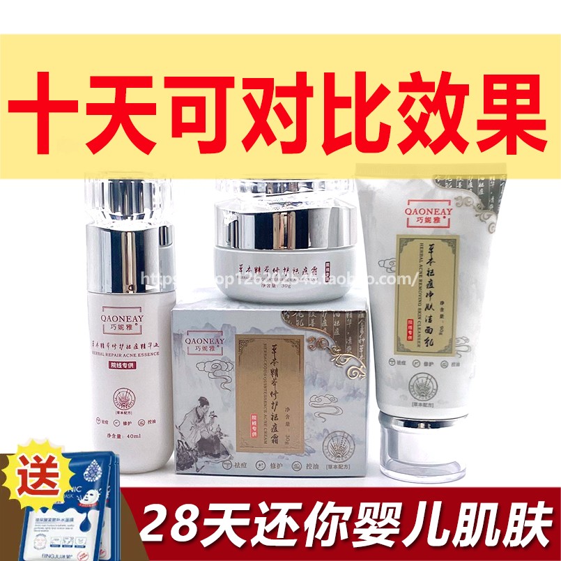 巧妮雅草本精华祛痘修护三件套祛痘痘印痘坑粉刺青春痘改善痘肌