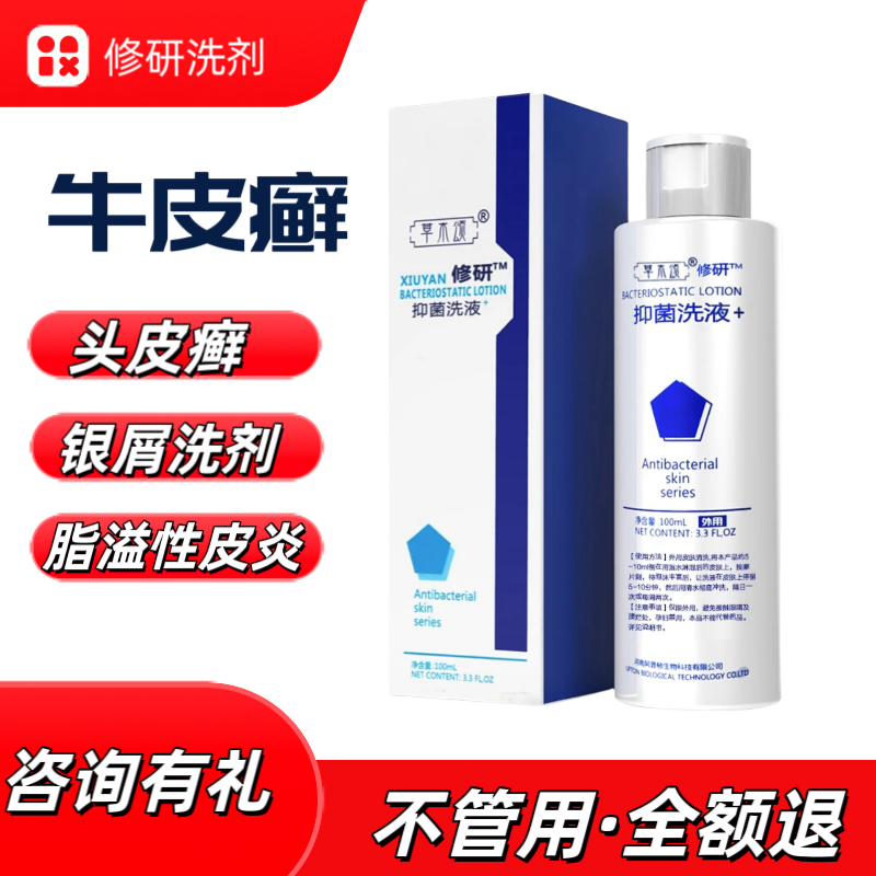 洗发水脂溢性皮炎头皮癣治止痒去屑软膏外用头癣头部