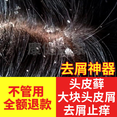 头皮护理去屑止痒洗发水