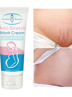 跨境Aichun身体乳清爽不油腻滋润去生长纹Stretch mark cream