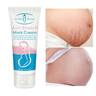 跨境Aichun身体乳清爽不油腻滋润去生长纹Stretch mark cream