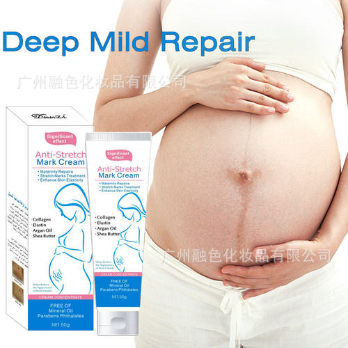严选跨境身体乳肚纹霜清爽不油腻滋润去生长纹Stretch mark cream