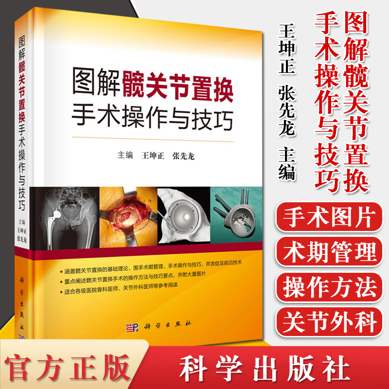 【正版现货】图解髋关节置换手术操作与技巧 王坤正 张先龙  髋关节置换基础理论书临床医学微创技术书籍科学出版社