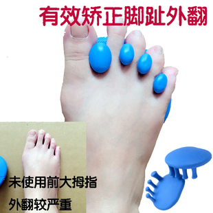 脚趾足弓训练器足底按摩垫分趾器外翻锻炼器扁平足趾骨矫正摇摇鞋