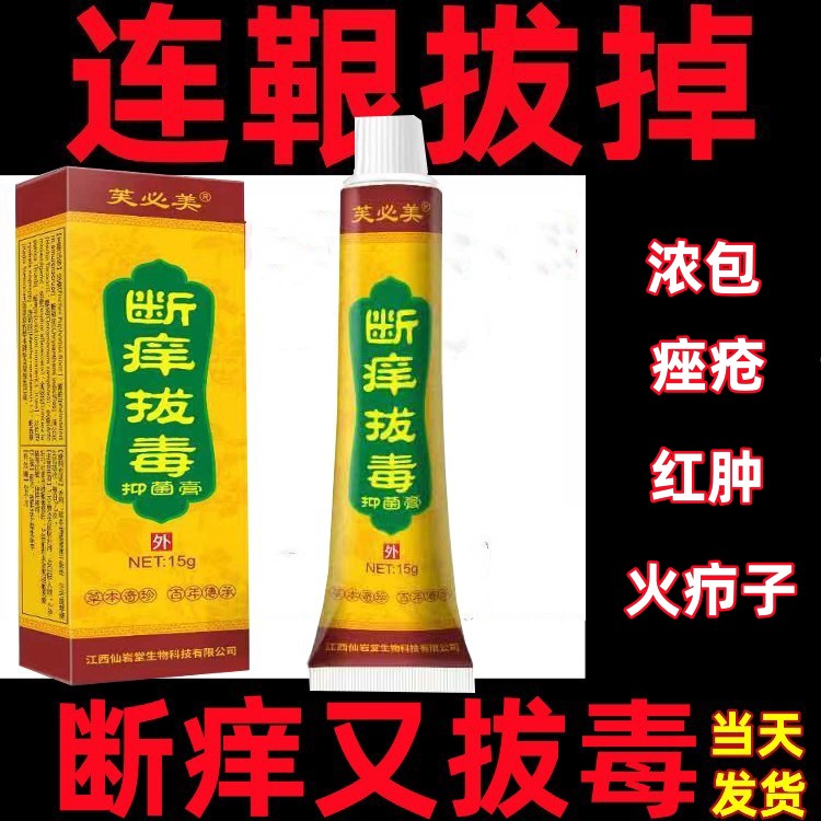 灰黄霉素人用灰黄霉素软膏甲癣抗真菌灰黄霉素头癣治头癣药膏外用