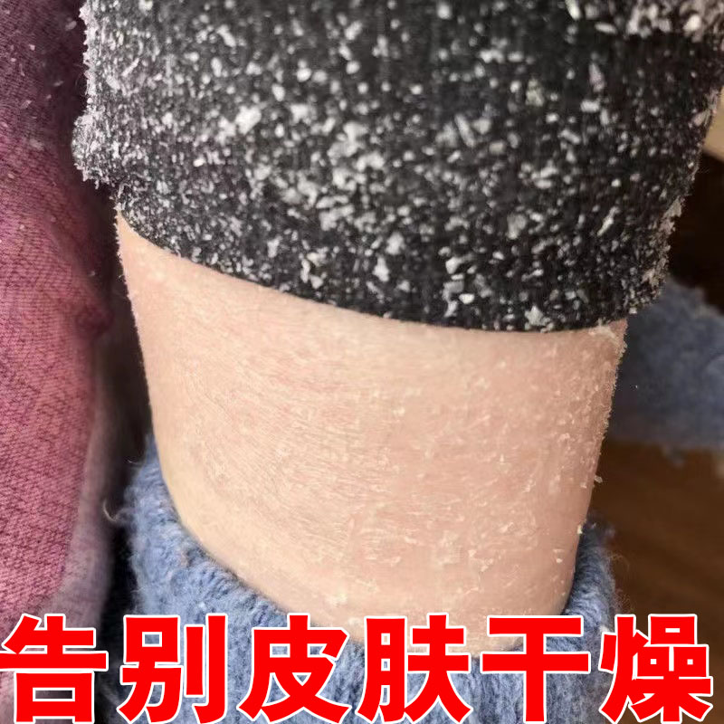 腿上干燥起皮痒过敏皮肤修复秋冬身体乳/霜