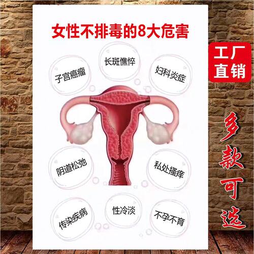 私密抗衰海报子宫排毒挂画妇科保养装饰画产后修复广告女性炎症图