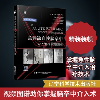 急性缺血性脑卒中介入治疗视频图谱内科生活辽宁科学技术出版社
