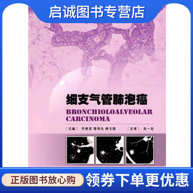 正版现货直发细支气管肺泡癌 乔贵宾 等主编 9787117111133 人民卫生出版社