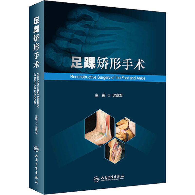 正版现货直发足踝矫形手术 外科 生活 人民卫生出版社