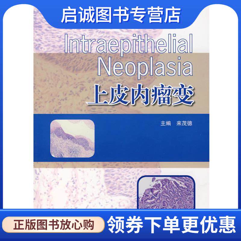 正版现货直发上皮内瘤变 来茂德　主编 9787040208511 高等教育出版社