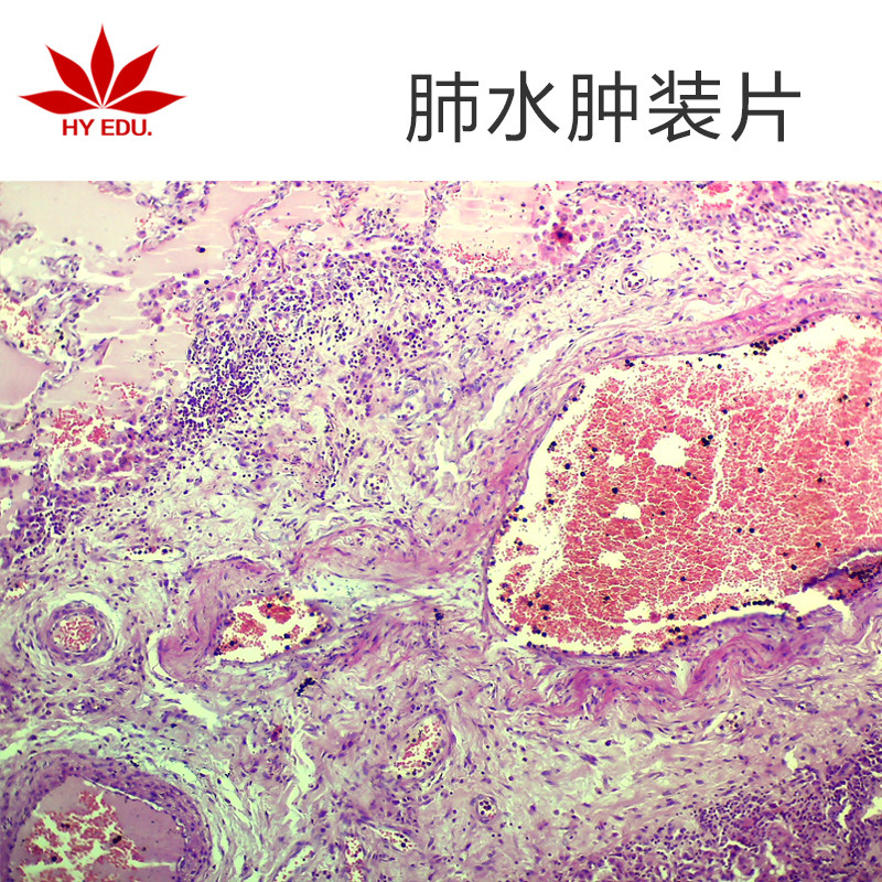 肺水肿生物切片 高教病理切片 组织细胞标本 玻璃载玻片 成像清晰