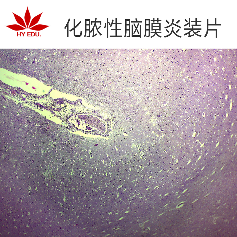 骨痂切片病理切片红叶