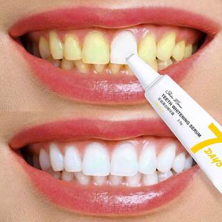 牙黄牙齿美白去黄 速效 黄牙 牙齿美白擦一擦即白去黄牙烟渍神器
