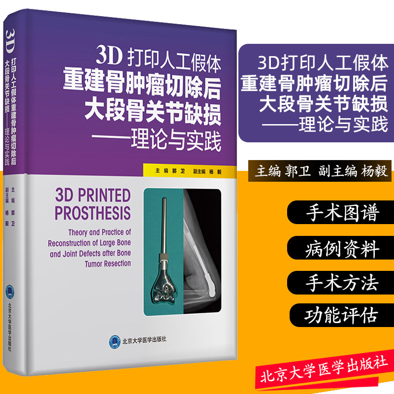 3D 打印人工假体重建骨肿瘤切除后大段骨关节缺损 理论与实践 郭卫 主编 骨科学 骨肿瘤外科医师 大量病例资料及手术图片肿瘤修复
