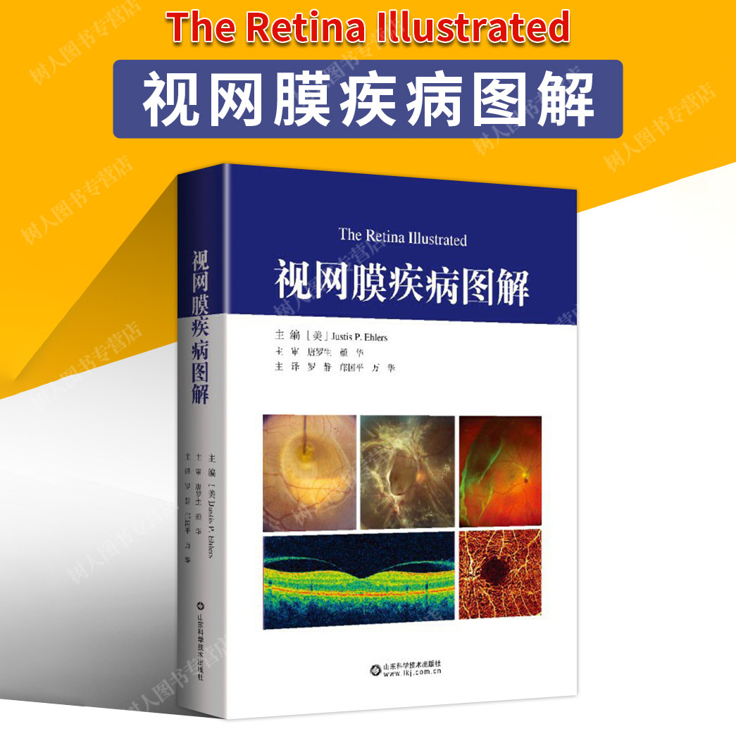 视网膜疾病图解成像技术超宽