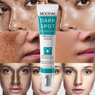 FRECKLE DARK 黑斑面霜 WHITENING CREAM SPOT REMOVAL