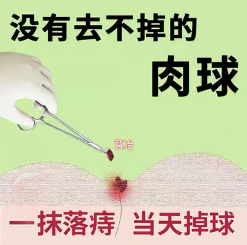 已拯救50万有痔青年】当晚就掉