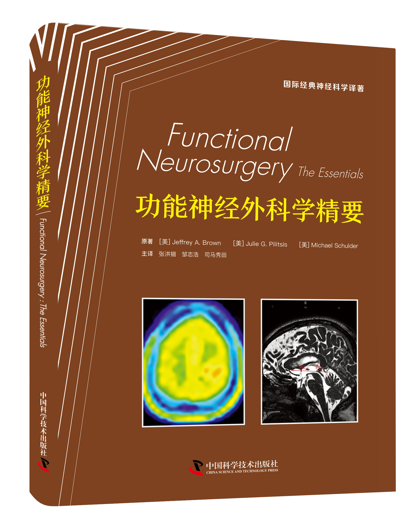 功能神经外科学精要 系统介绍神经外科新兴领域 深入剖析功能性疾病诊疗方案 聚焦相关行业关键核心技术 汇聚临床大量实践新进展