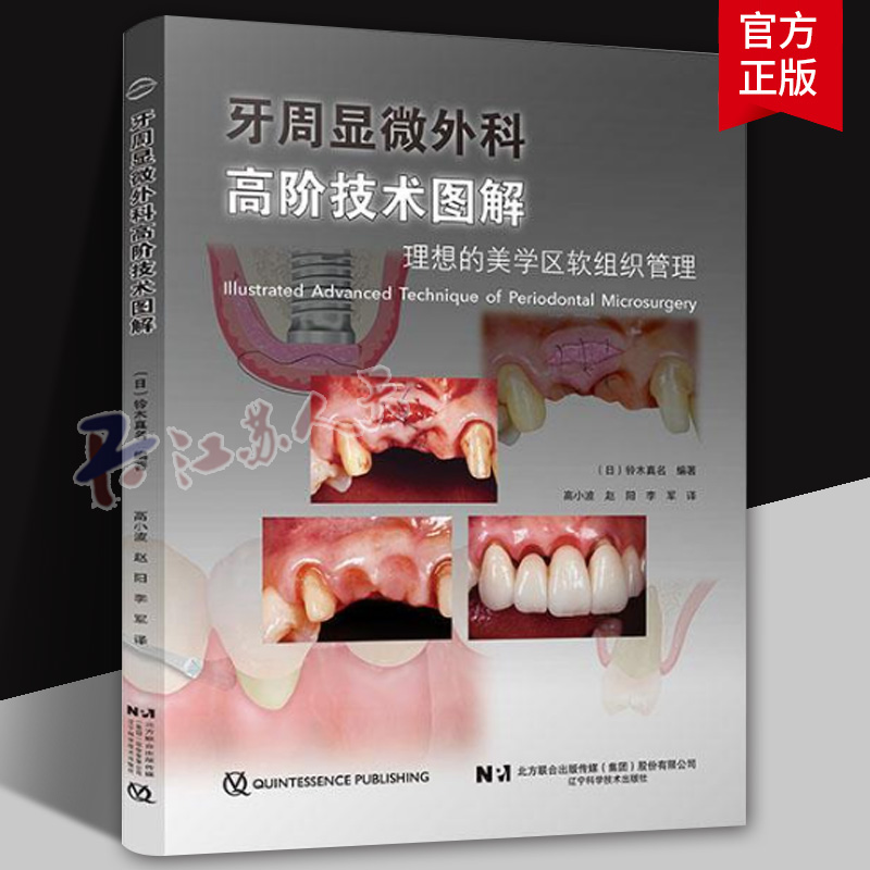 牙周显微外科高阶技术图解 理想的美学区软组织管理 高小波 赵阳 李军 译 辽宁科学技术出版社9787559136244