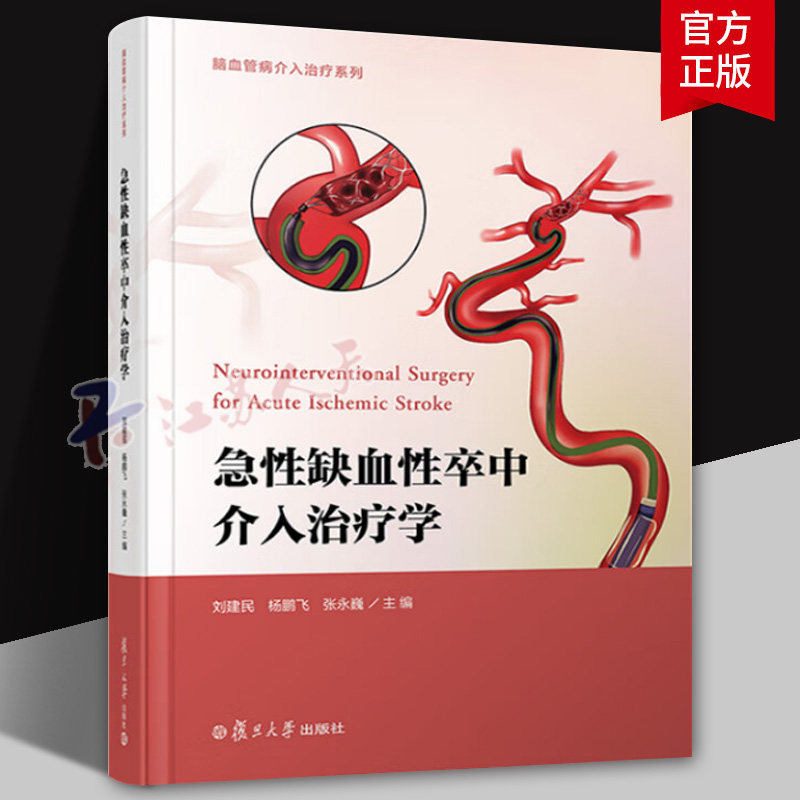急性缺血性卒中介入治疗学 脑血管病介入治疗系列 刘建民 杨鹏飞 张永巍主编 复旦大学出版社9787309176346