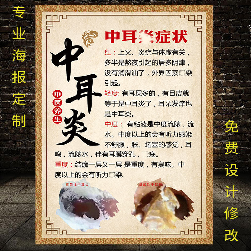 中耳炎海报采耳广告图片文化耳烛挂图症状耳疗耳朵护理图片宣传画