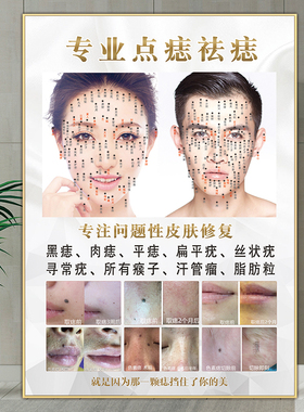祛痣广告图点痣宣传图kt板男女面痣图取痣挂画痣相图祛痣祛疣海报