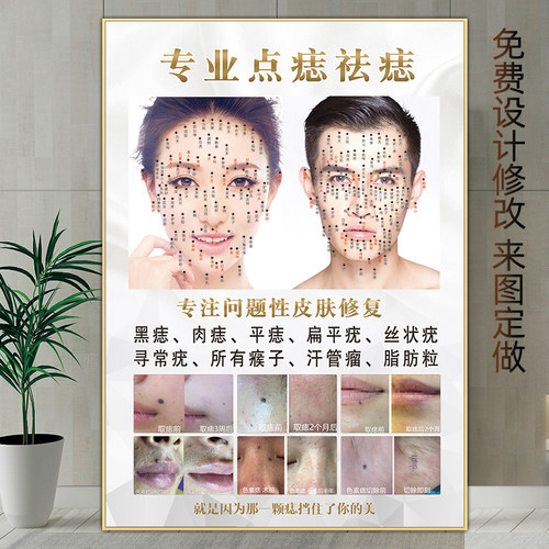 祛痣海报点痣广告图男女面痣图