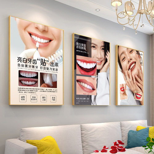美牙海报全瓷牙宣传画牙贴面挂画