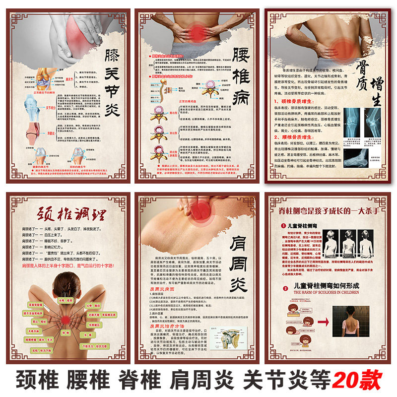颈椎图片膝关节炎宣传画骨质增生挂画脊柱图腰椎病症图肩周炎海报,个性定制/设计服务/DIY,写真/海报印制,淘宝优惠券,粉丝福利购,淘宝优惠卷