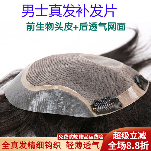 假发头顶帅气男士前额隐形