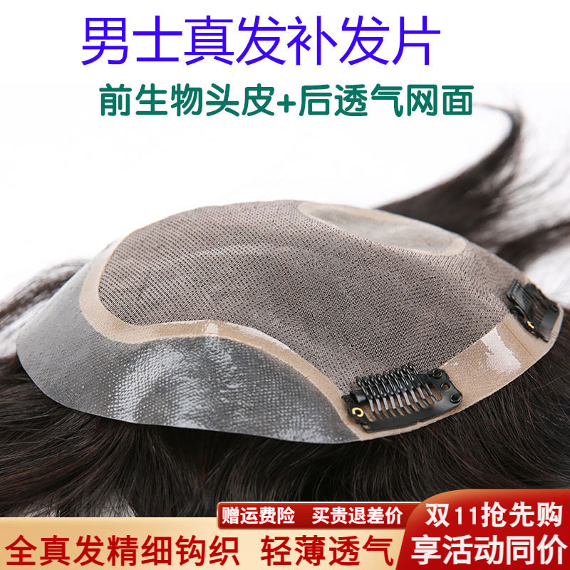 假发头顶帅气男士前额隐形