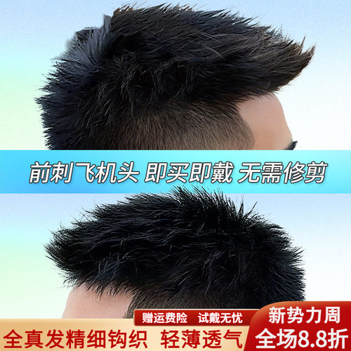 假发男头顶补发前刺男士