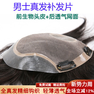 假发男头顶补发男真发短发帅气织发补发片男士秃顶前额发际线隐形