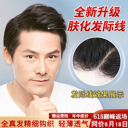 假发男士头顶补发递针全真发织发块秃顶肤化发际线隐形无痕短毛寸
