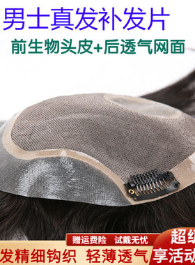 假发头顶帅气男士前额隐形