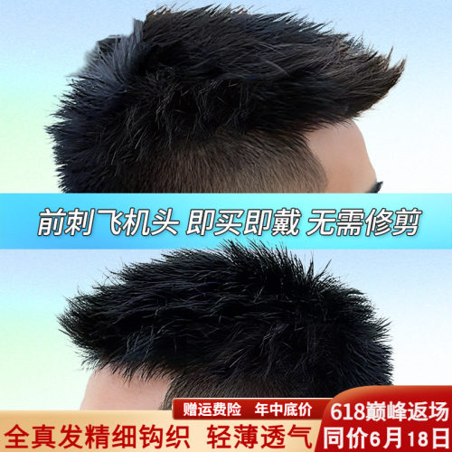 假发男头顶补发前刺男士