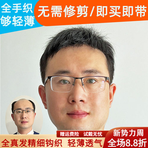 米尔真人发丝头顶补发片够轻薄