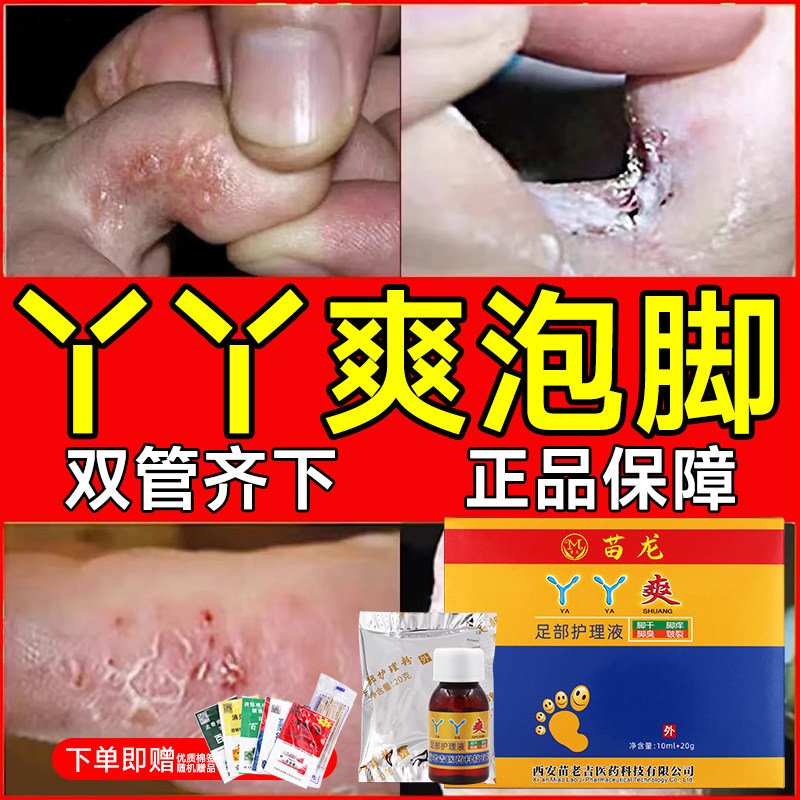 丫丫爽足部抑菌护理液草喷雾