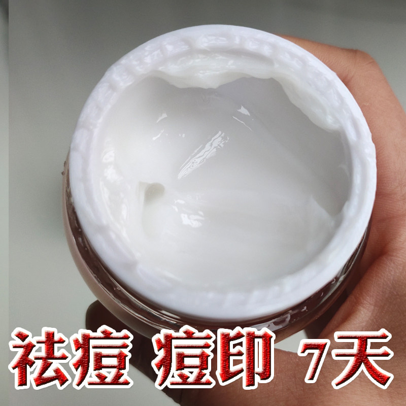 纯中药祛痘面霜敏感肌青春痘痘印消炎红肿闭口粉刺痤疮控油膏男女