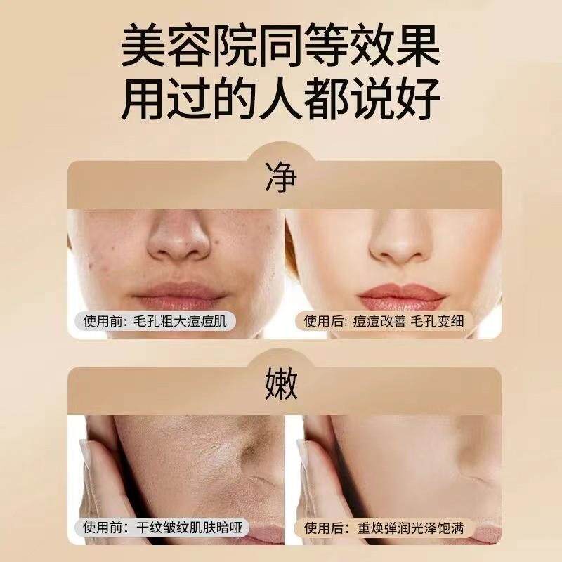 光子嫩肤美容仪家用脸部祛痘印淡斑LED仪器红蓝光面罩大排灯补水