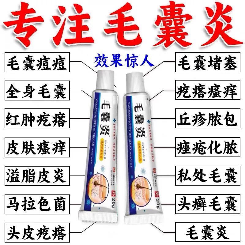 毛囊炎长脓包疙瘩抑菌止痒消炎膏