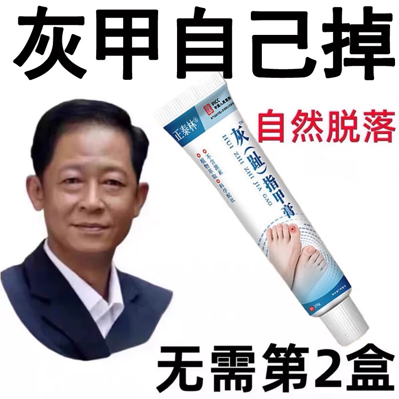 灰指甲专用严重甲沟炎抑菌亮甲膏