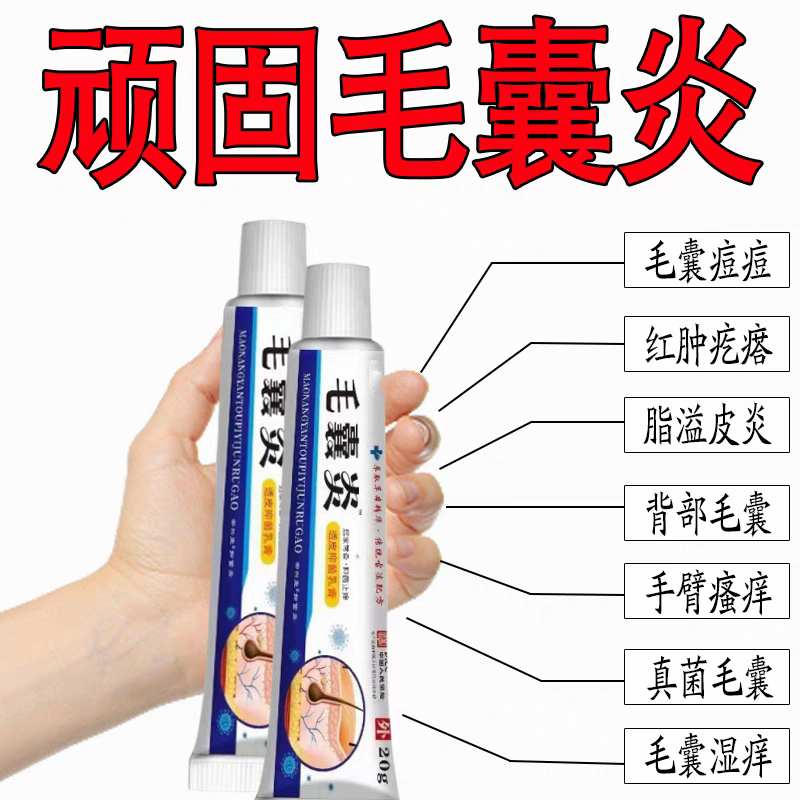 毛囊炎长脓包疙瘩抑菌止痒消炎膏