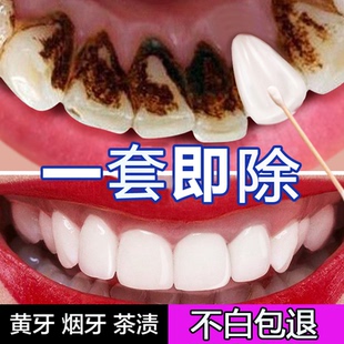 强力去烟渍牙膏洗牙粉溶解牙结石祛除器牙齿美白速效黄牙亮白口臭