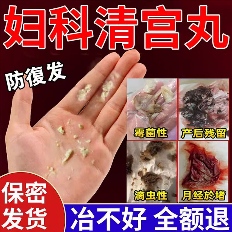 静若姿清宫丸中药排毒正品拉线妇科杀菌子宫收阴道排毒紧致缩凝胶