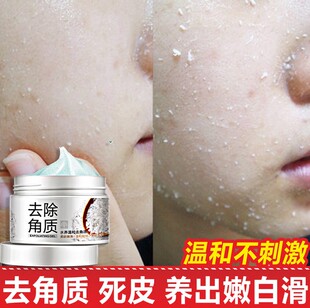 男女士面部去死皮去角质霜膏磨砂温和清除脸部角质层脱皮老化皮肤