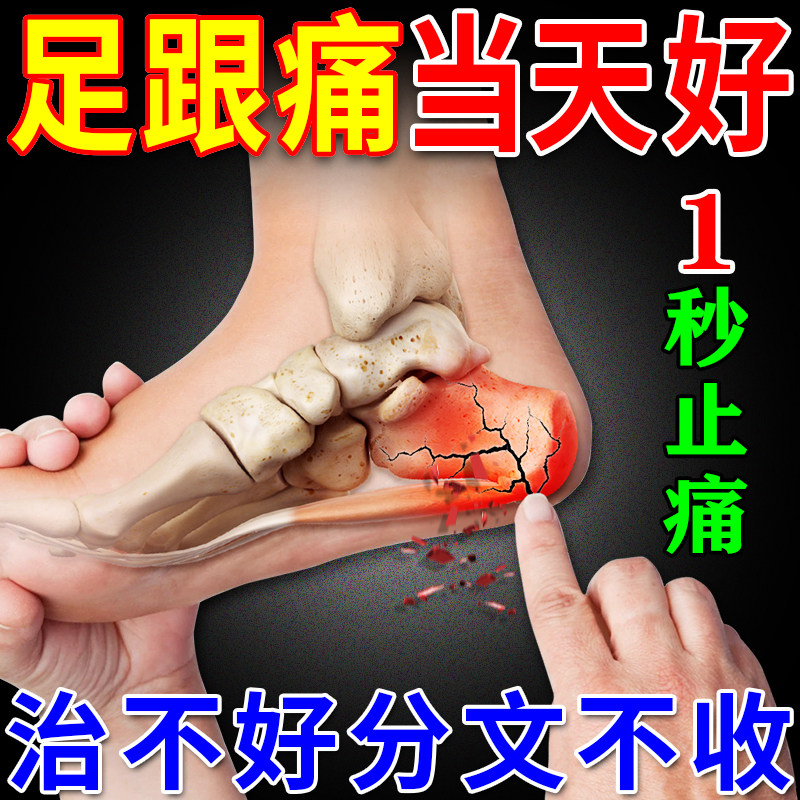 足跟痛特效药治疗后脚跟疼痛专用药膏足底筋膜痛跟腱炎骨刺痛神器
