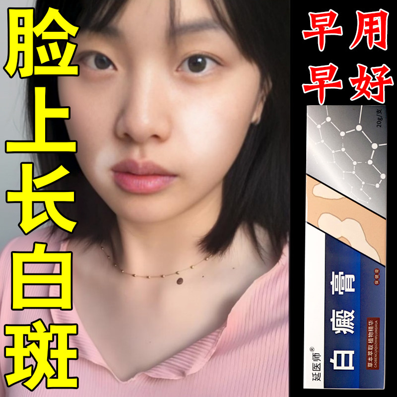 白斑专用神器促进黑色素生长药手皮肤消毒护理（消）