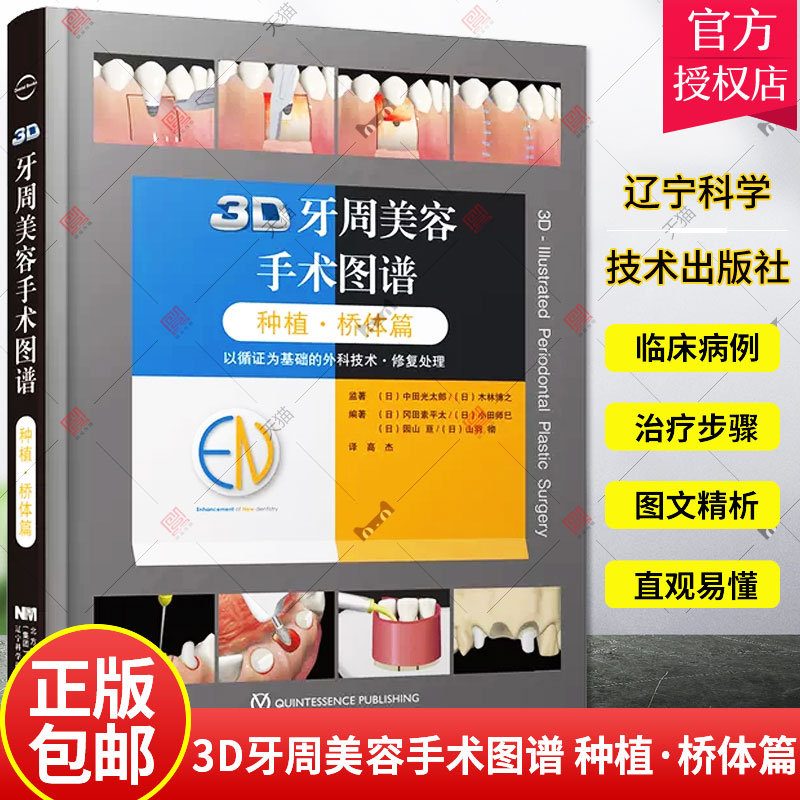 3D牙周美容手术图谱 种植·桥体篇 口腔科书籍 医学参考书籍 2020年1月DIYI版 冈田素平太等编 著 9787559117243 辽宁科学技术出版